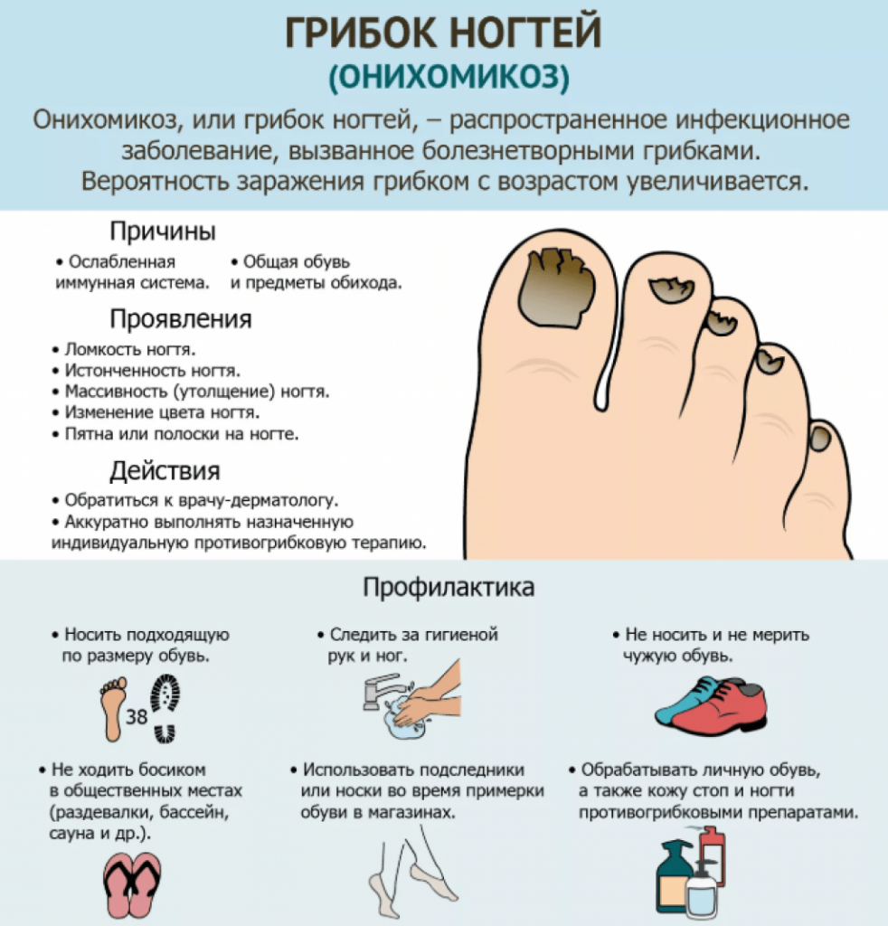 Причины нарушения кожи. Грибок ногтей онихомикоз. Грибковое поражение ногтей на ногах. Как лечить грибок на ногтях на ногах. Грибковые инфекции ногтей онихомикозы.